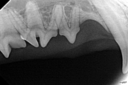 Digital Dental Radiology  San Antonio, TX
